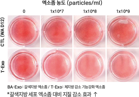 oro 염색이미지1