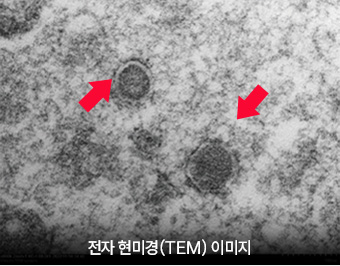 전자 현미경(REM